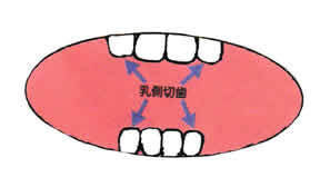乳中切歯
